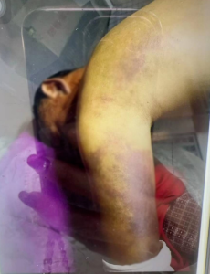 果敢同盟军正在对缅北多地民宅进行搜查，有居民称一男子因私藏此物被殴打致死！-千博